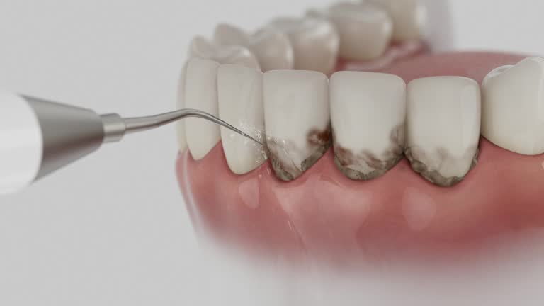 Reliable Tooth Extraction contractor in Jackson, MS by Smile Center Dentistry